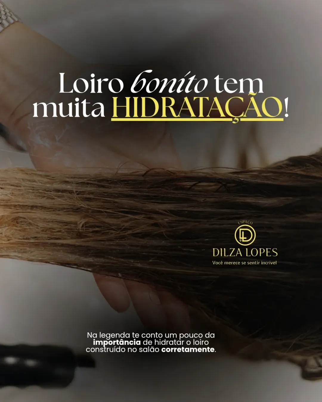 Dilza Lopes
